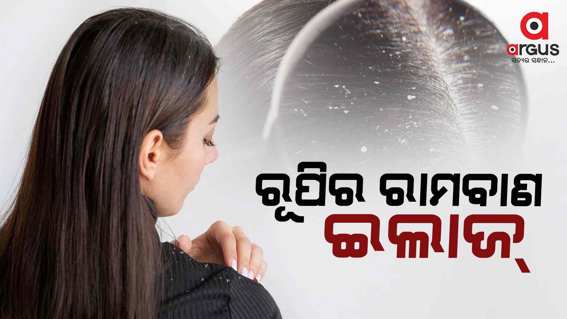 ଶୀତଦିନେ ରୂପିକୁ ନେଇ ଚିନ୍ତିତ କି... ଜାଣନ୍ତୁ ଏହି ଉପଚାର