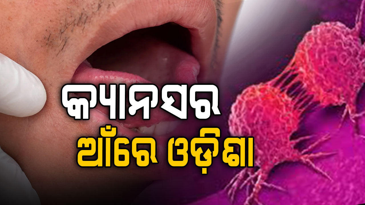 ଓଡ଼ିଶାରେ ମାଡ଼ିଗଲାଣି କ୍ୟାନସର, ବର୍ଷକୁ ବାହାରୁଛନ୍ତି ୫୫ ହଜାର କର୍କଟ ରୋଗୀ