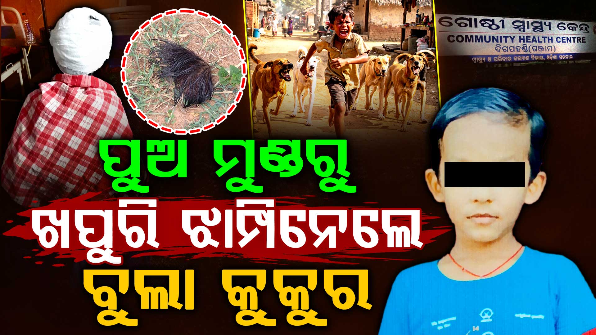 ବୁଲା କୁକୁରଙ୍କ ଆକ୍ରମଣ: କୁନି ପୁଅର ମୁଣ୍ଡରୁ ନେଇଗଲେ ମାଂସ