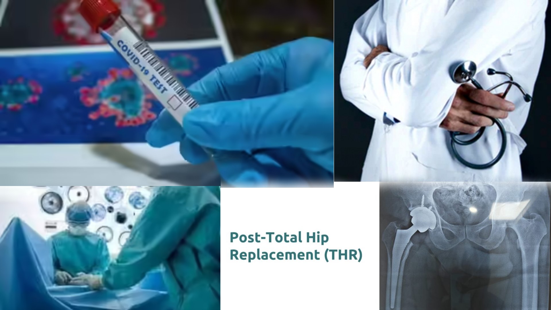 Hip Replacement Surgeries Surge 40% Among Younger Indians Post-COVID